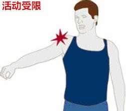 有肩周炎病,買的膏藥貼在哪個地方是正確的?